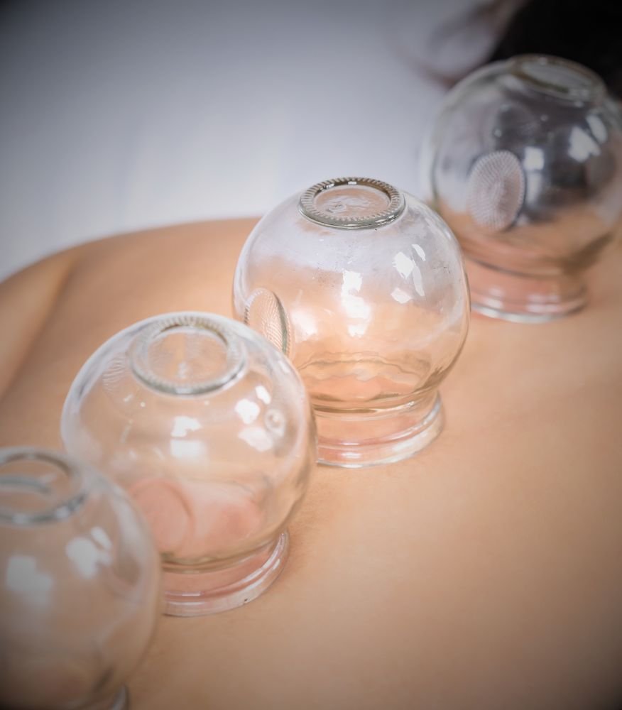 Cupping in Da Nang